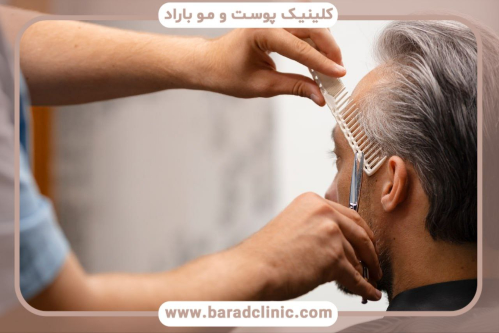 بهترین کلینیک کاشت مو در تهران