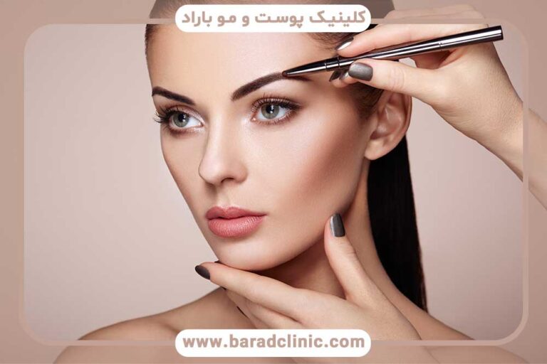 Mistakes after eyebrow transplantation