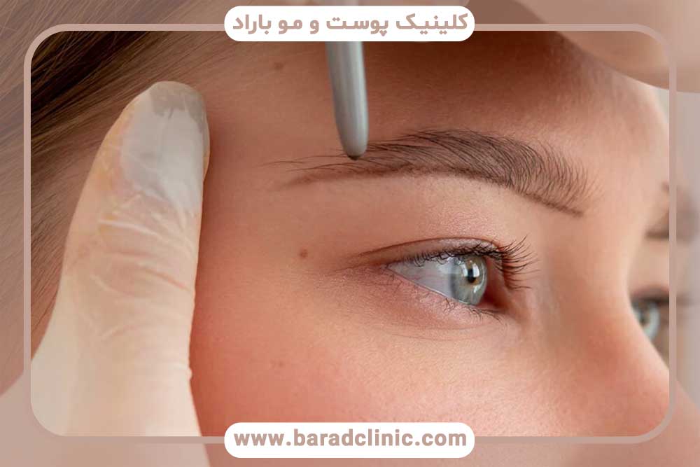 Eyebrow implant pain