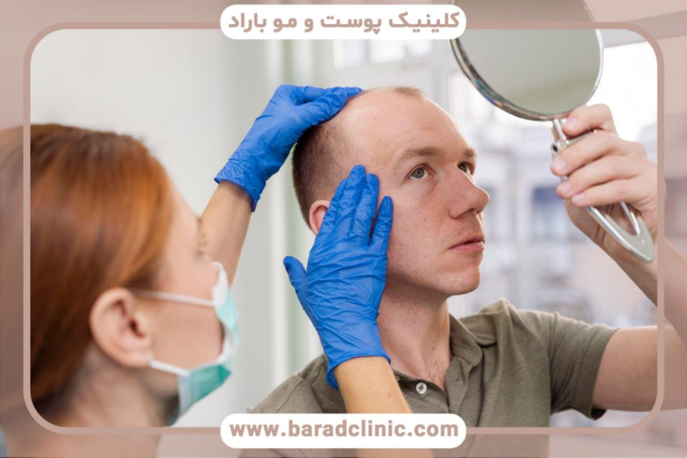 راهنمای انتخاب بهترین مرکز کاشت مو در تهران