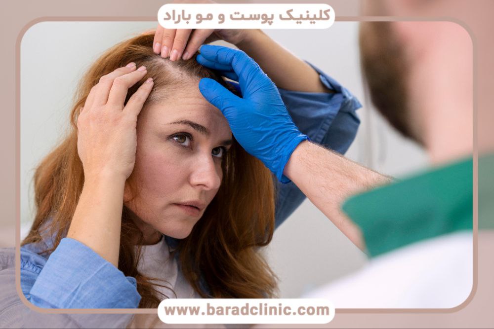 هزینه کاشت مو