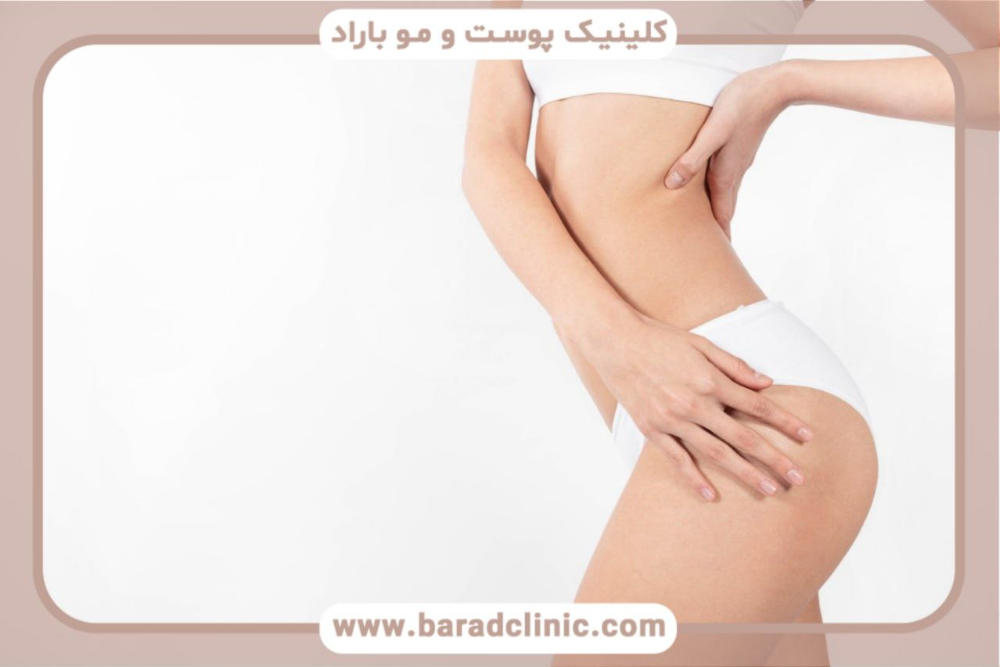 پیکرتراشی-به-روش-لیپوساکشن