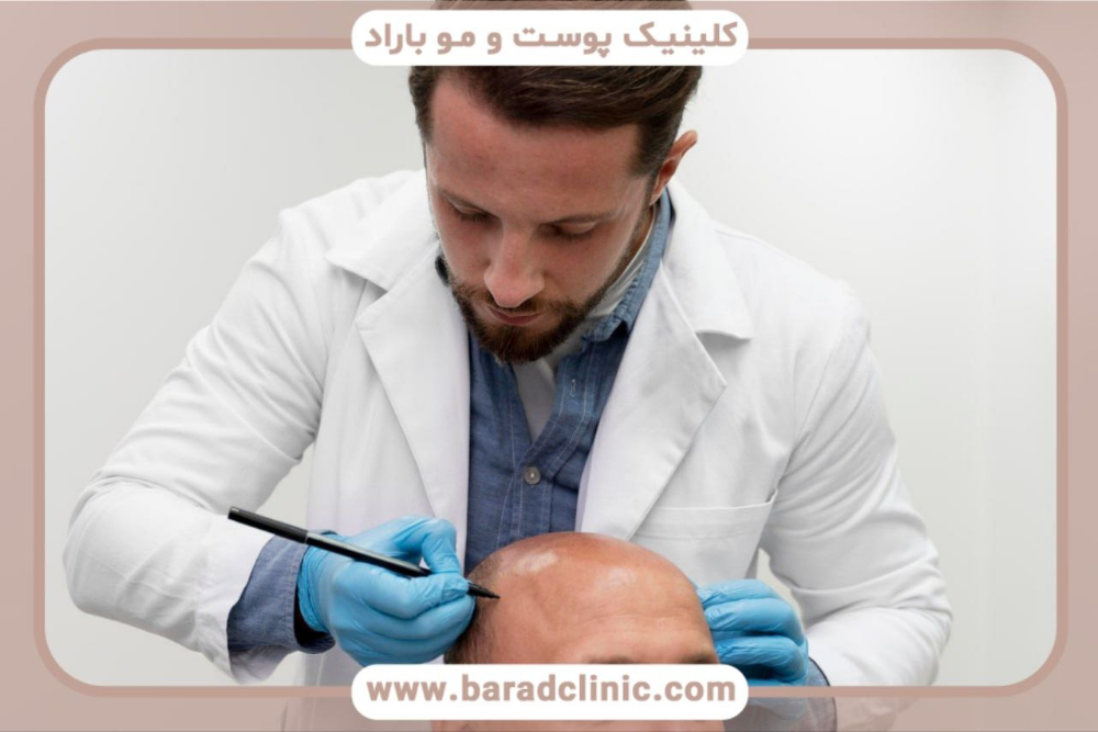 کاشت مو ناموفق