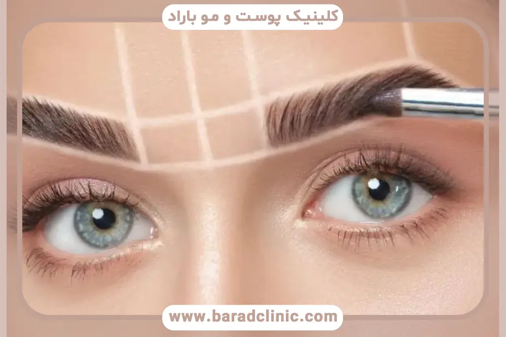 قیمت کاشت ابرو در تهران