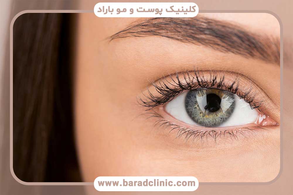 The best time for eyebrow transplantation