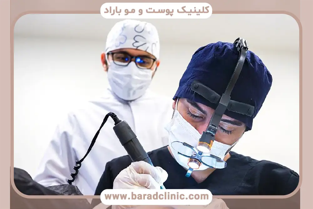 سن کاشت ریش