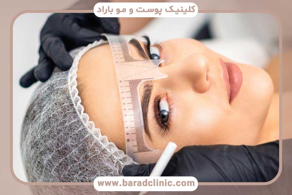 بهترین روش‌های کاشت ابرو