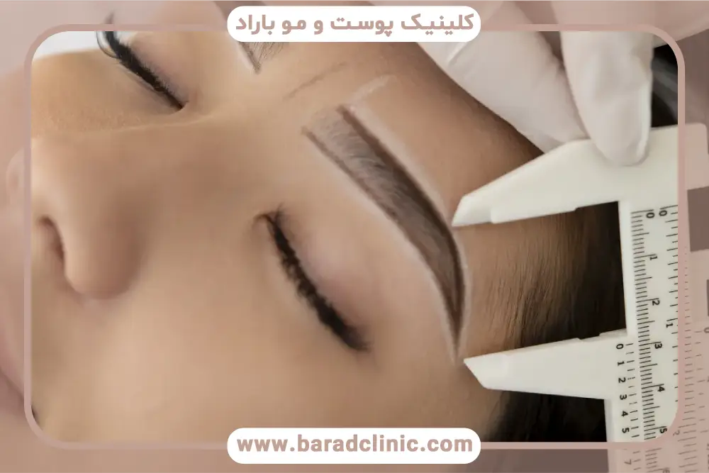 تاثیر تراکم ابروها روی قیمت کاشت ابرو در تهران 