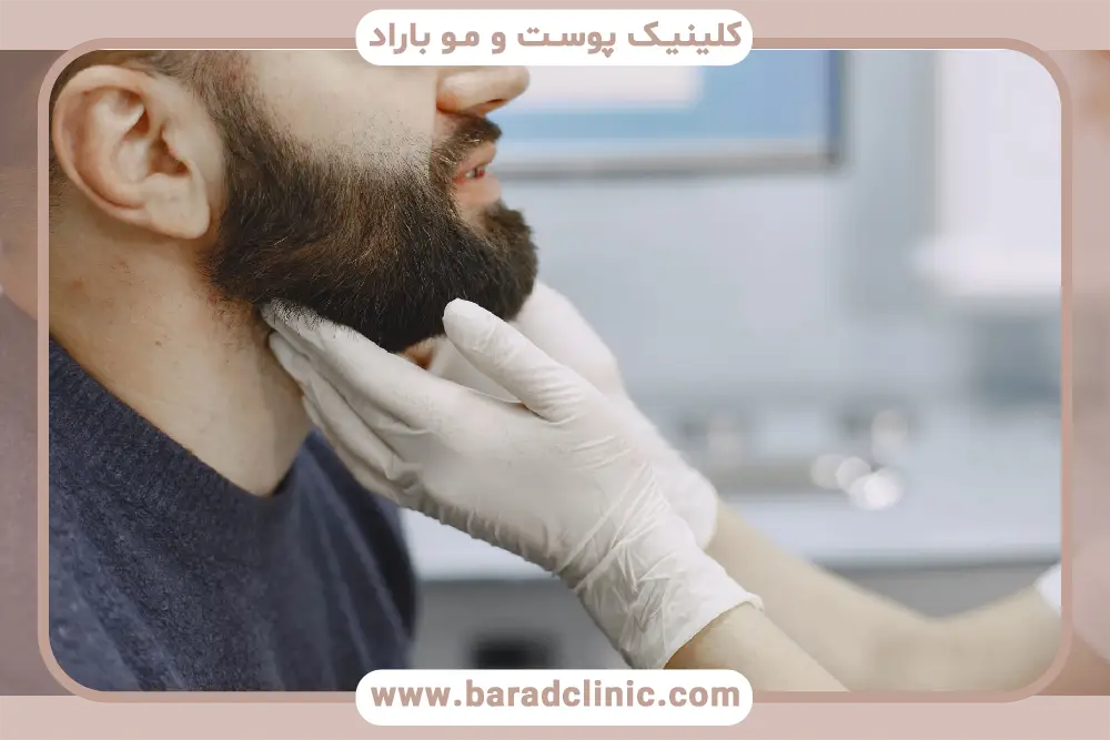 اهمیت انتخاب بهترین سن کاشت ریش 