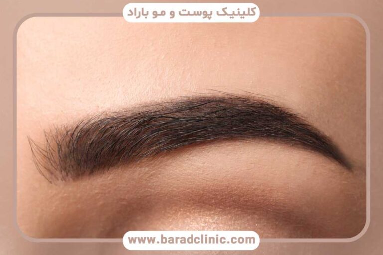 بهترین روش‌های کاشت ابرو