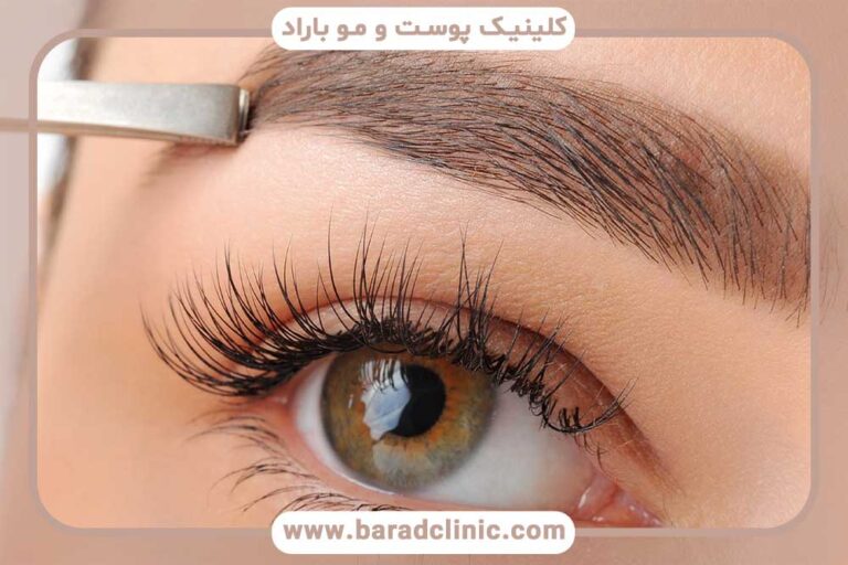 مراقبت‌های ضروری بعد از کاشت ابرو