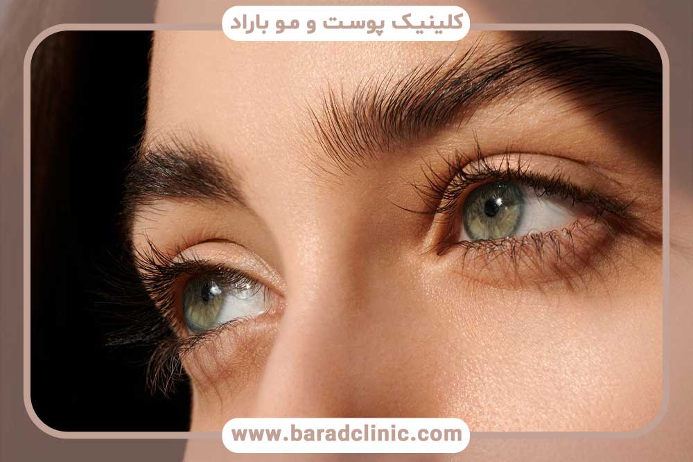 کلینیک مطمئن برای بلفاروپلاستی