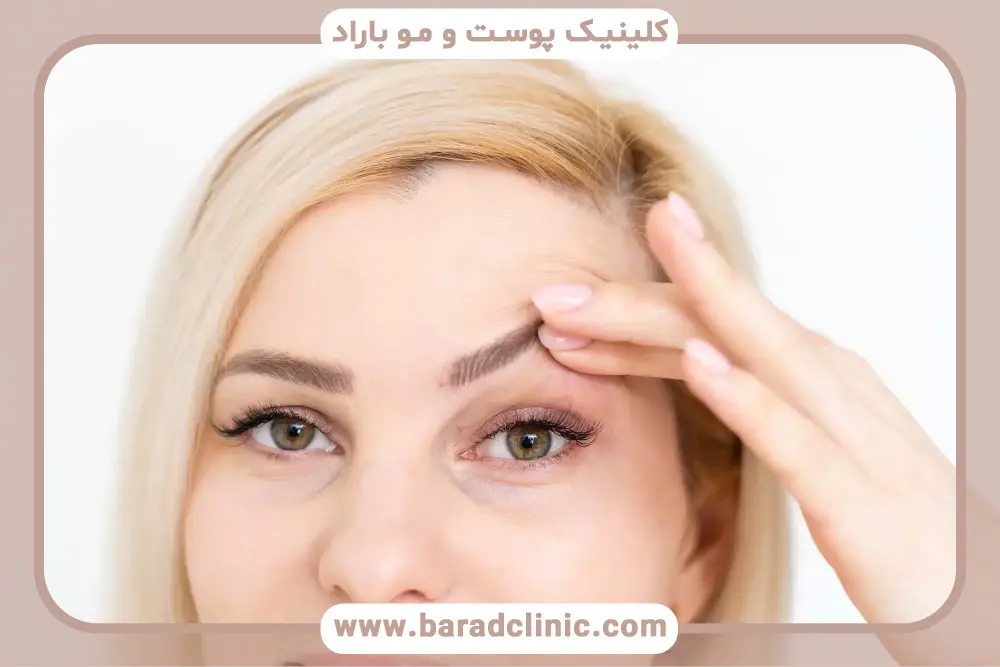 زمان بازگشت به روتین حمام بعد از بلفاروپلاستی 