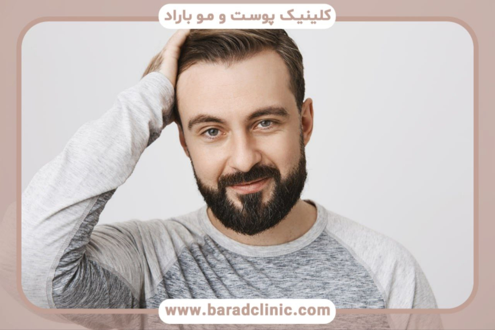 اصول طراحی خط رویش طبیعی در کاشت مو سر شامل گرادیان تراکم، زاویه کاشت، طراحی غیرمتقارن و رعایت آناتومی صورت برای نتیجه‌ای طبیعی و ماندگار 