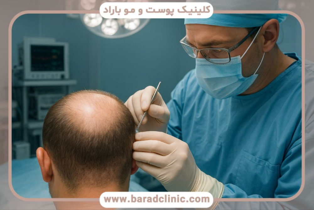 پزشک در حال آماده‌سازی ناحیه گیرنده برای کاشت مو، تزریق بی‌حسی موضعی و فیلم کاشت مو