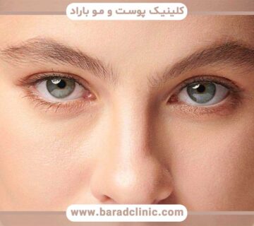 Combining blepharoplasty with other facial cosmetic surgeries