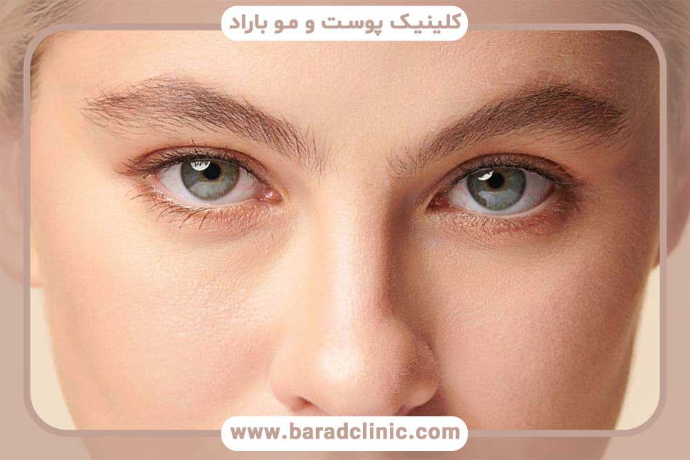 Combining blepharoplasty with other facial cosmetic surgeries