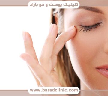Possible complications of blepharoplasty