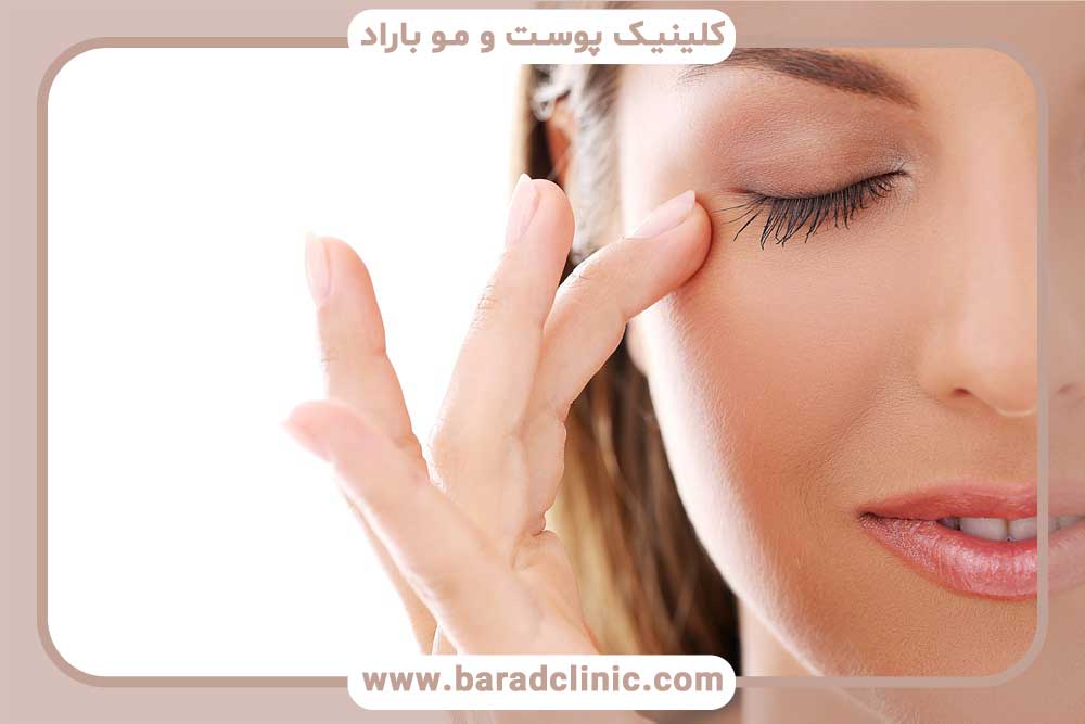 Possible complications of blepharoplasty
