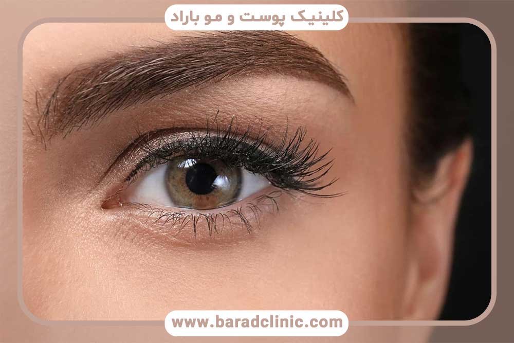 Durability of eyebrow transplantation