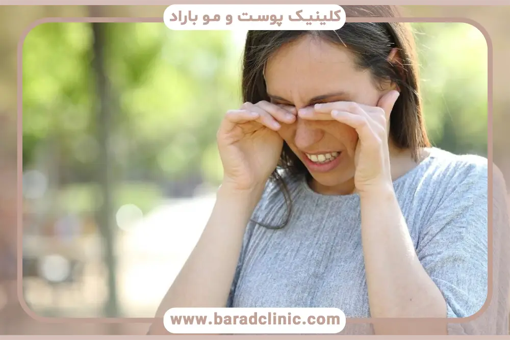 خارش پلک بعد از بلفاروپلاستی