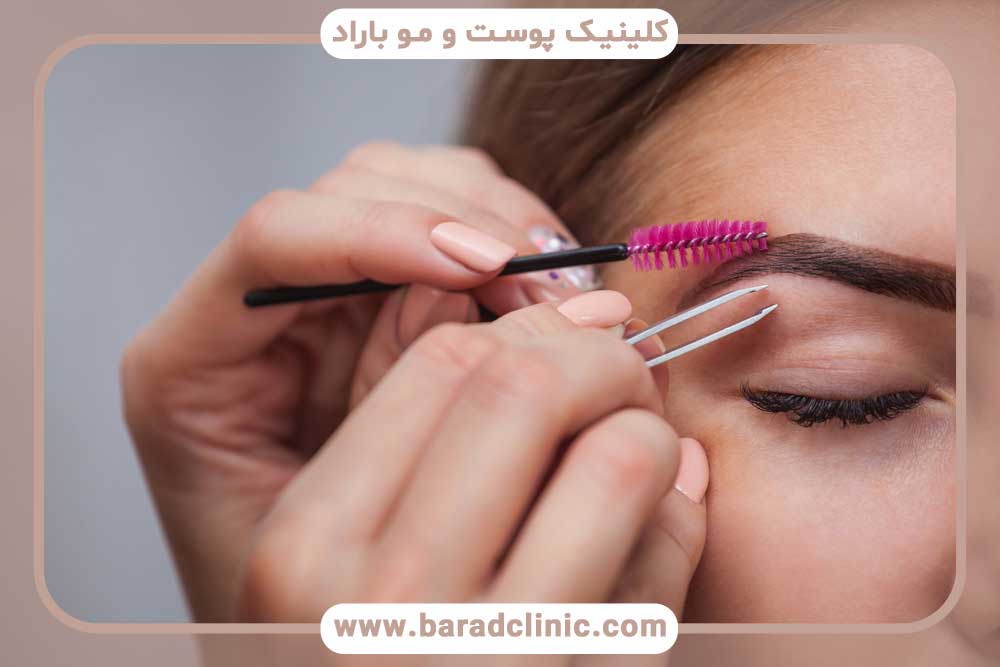 قیچی ابرو بعد از کاشت