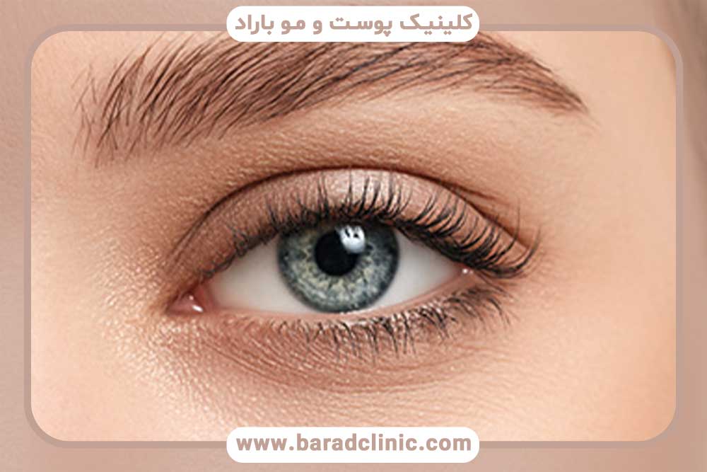 مدرک کاشت ابرو