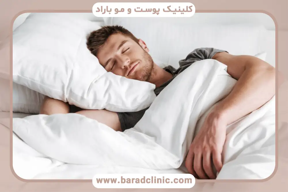 خوابیدن بعد از بلفاروپلاستی