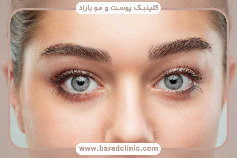 جلسات کاشت ابرو