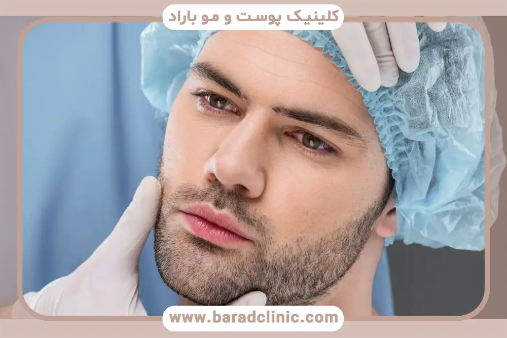 کاشت ریش اقساطی