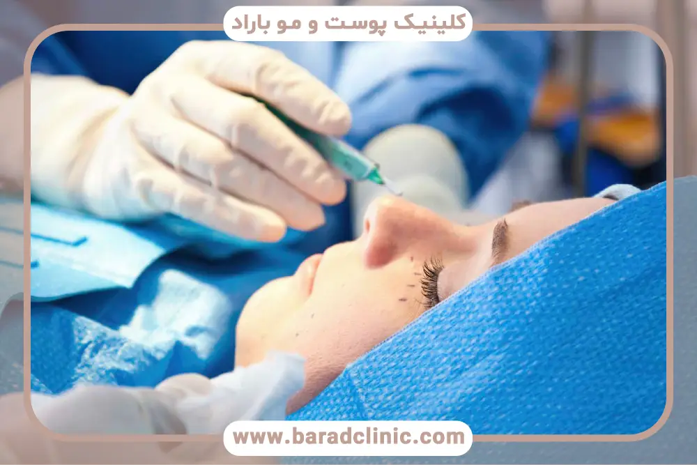 بلفاروپلاستی درمانی