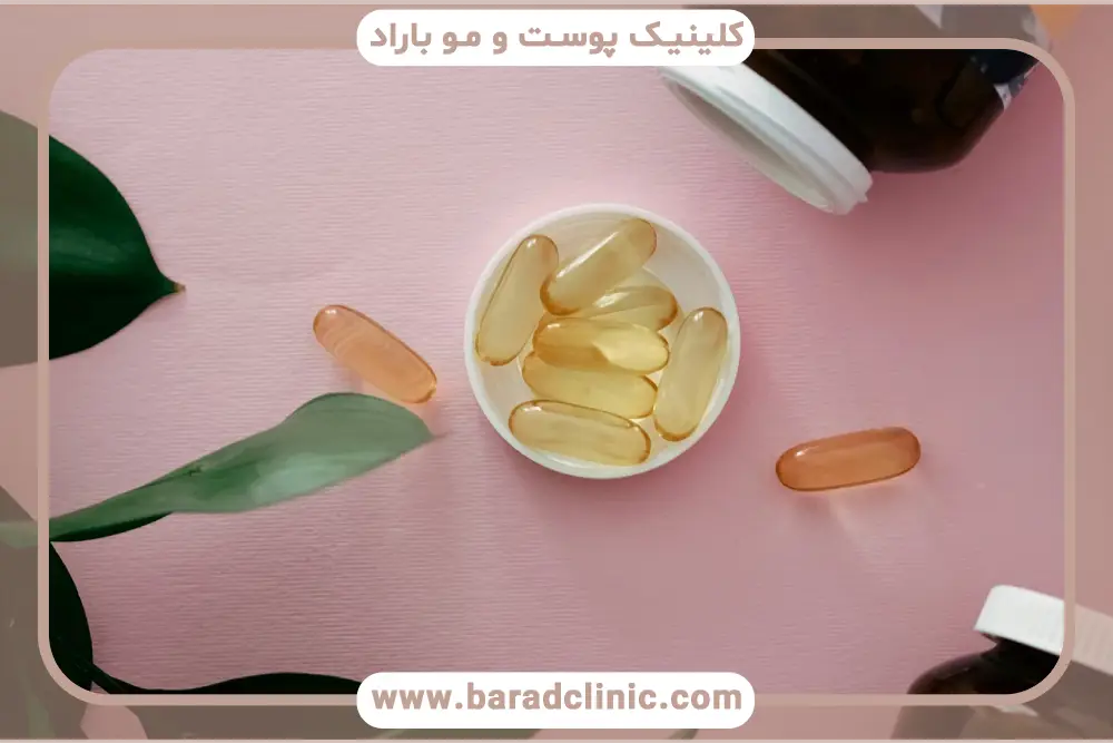 بهترین قرص بعد از کاشت مو