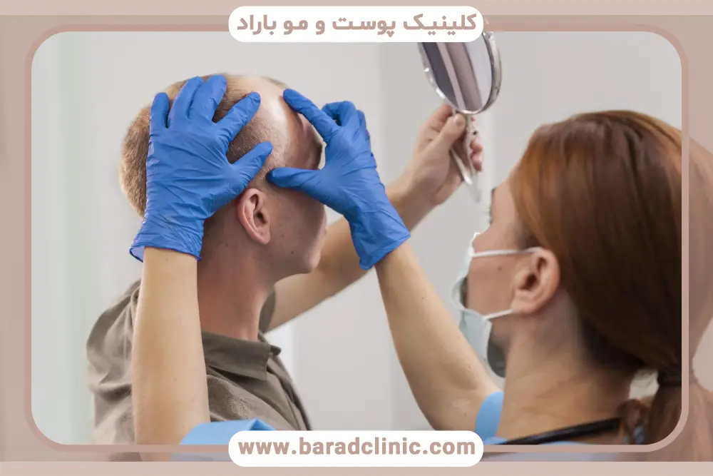 مشاوره رایگان کاشت مو