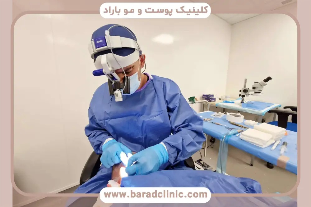 قیمت کاشت مو در تهران