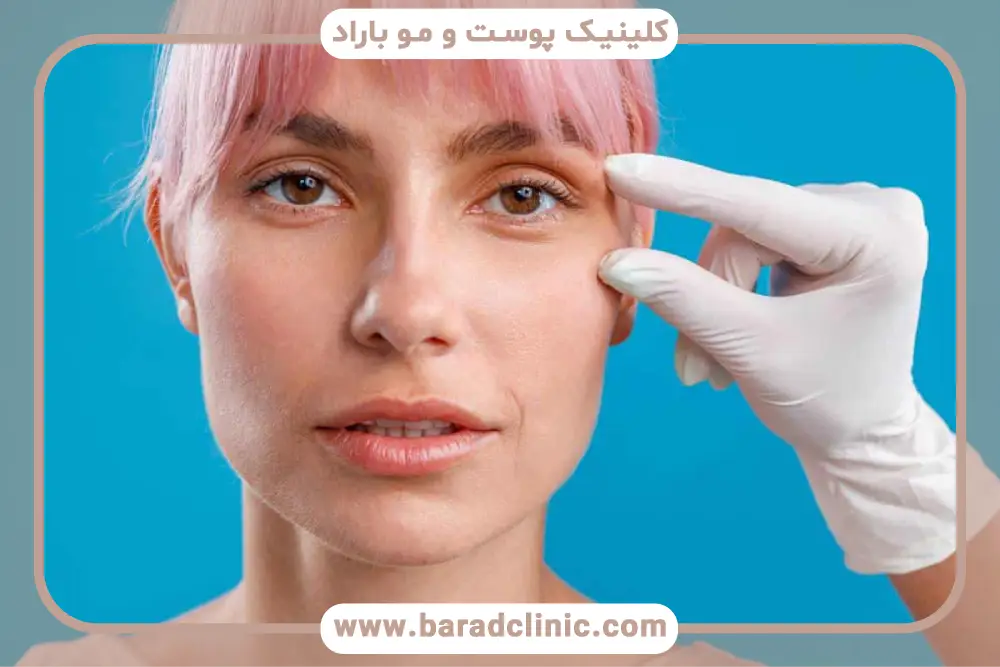 فرق کانتوپلاستی و بلفاروپلاستی