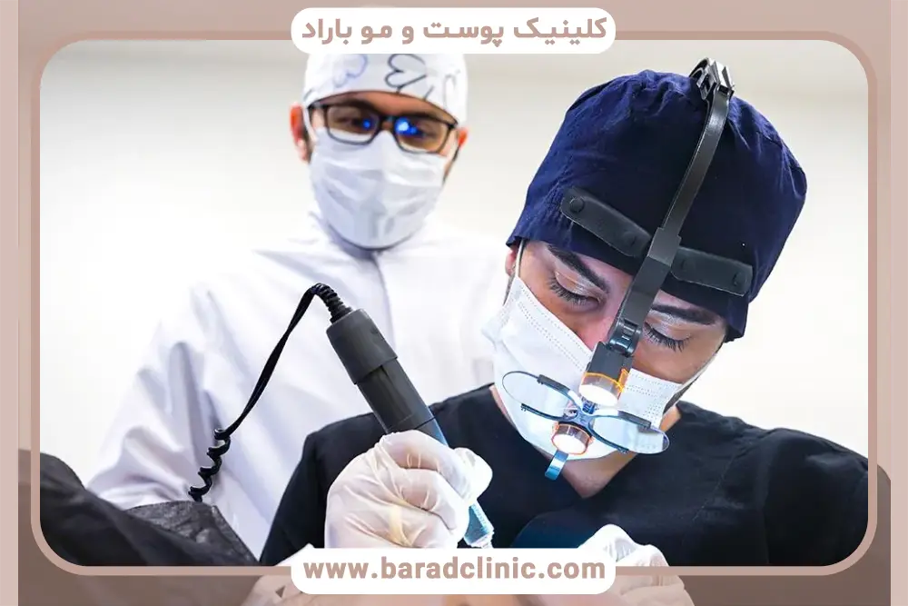 کاشت ریش به روش fut