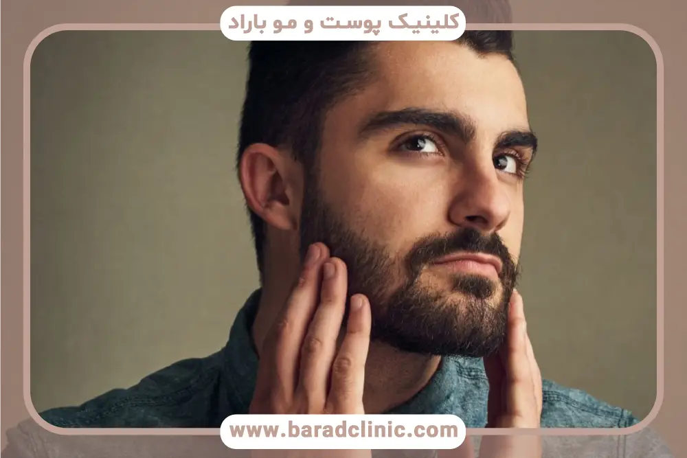 کاشت ریش در جای زخم