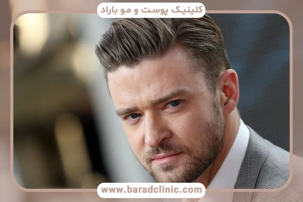 کاشت مو مصنوعی