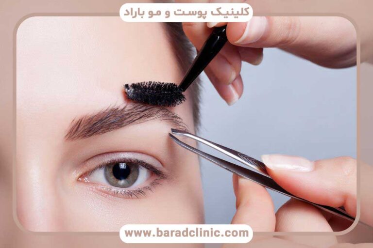 کارهای ممنوع بعد از کاشت ابرو