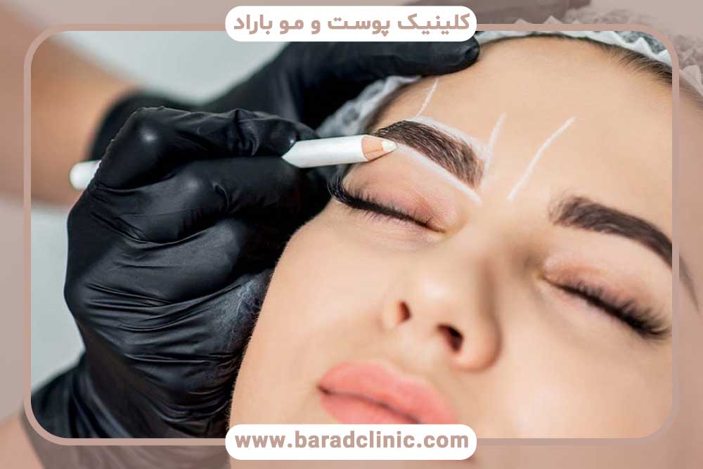 کاشت ابرو طبیعی