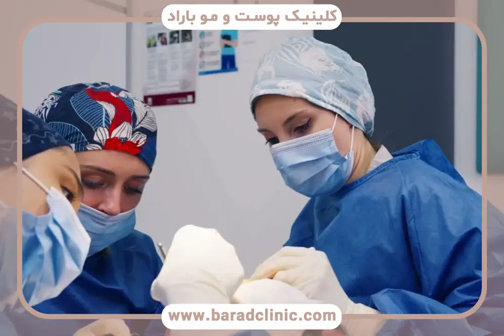 کاشت ریش چند ساعت طول میکشد