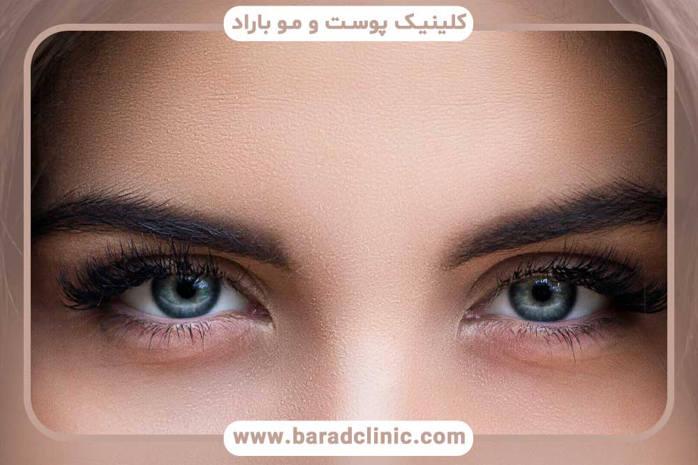 عمل کاشت ابرو