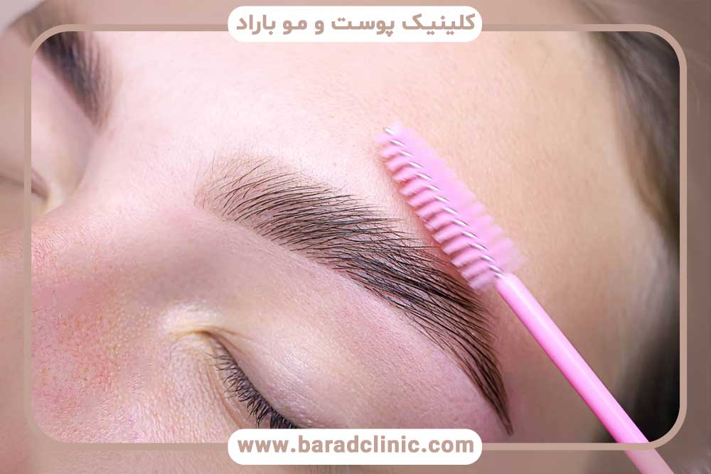 قیچی ابرو بعد از کاشت