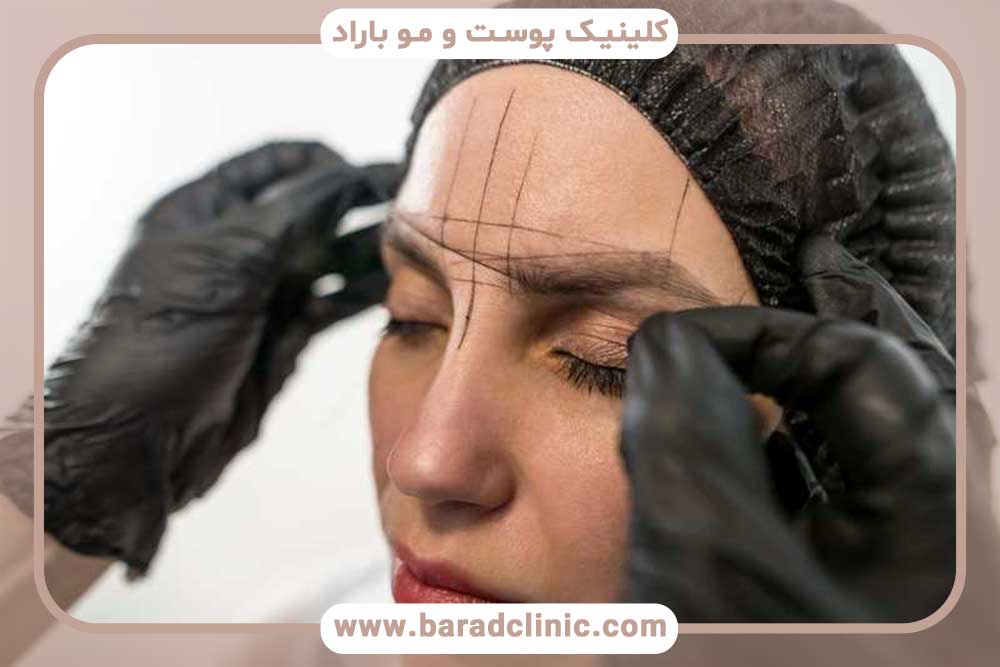 مدرک کاشت ابرو