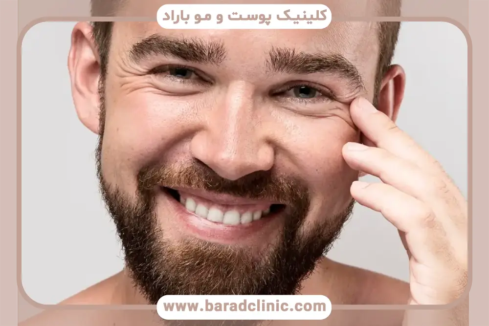 اعتبار بهترین کلینیک کاشت ریش در تهران 
