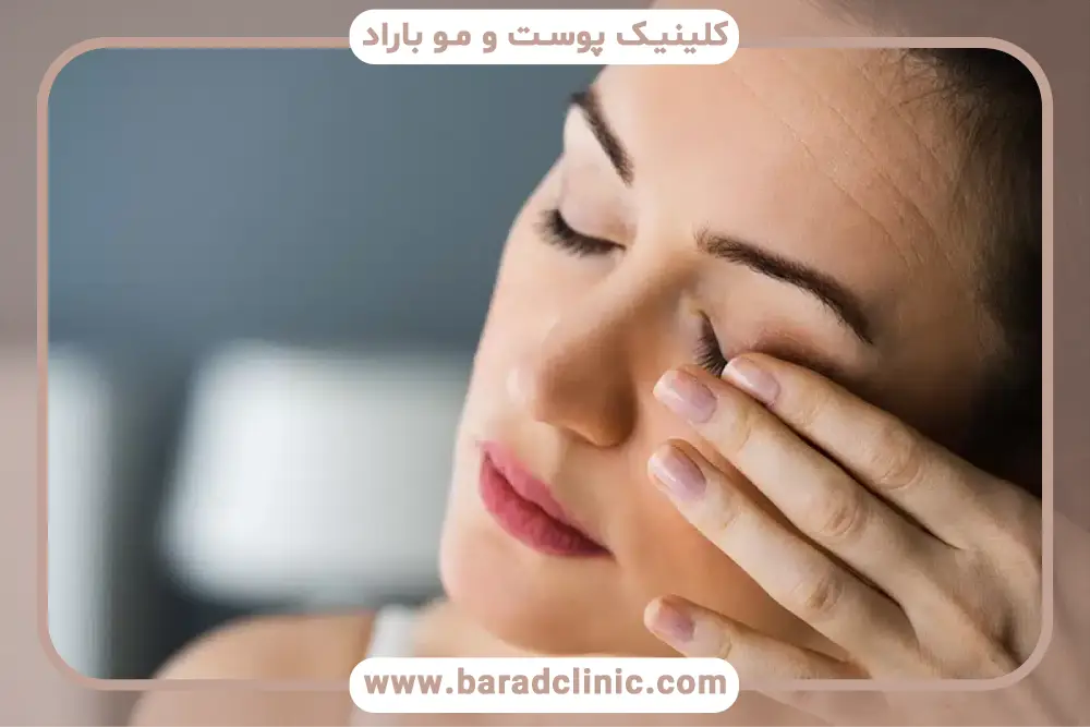 اهمیت خوابیدن بعد از بلفاروپلاستی 