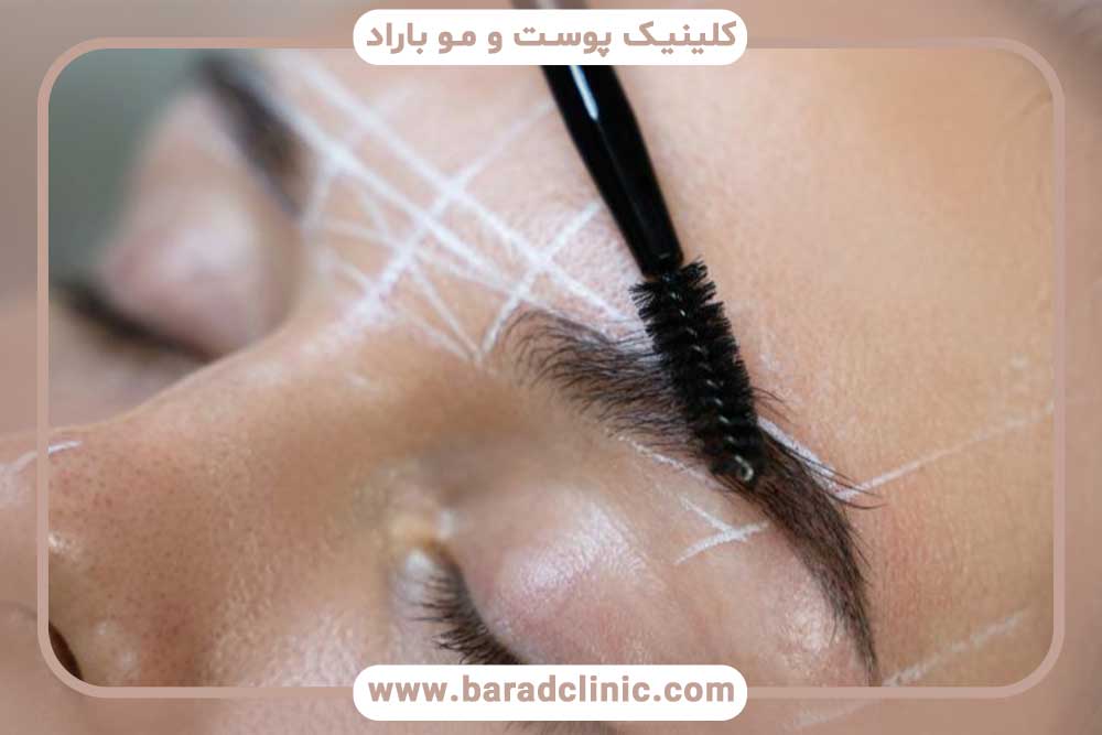 زمان جلسات کاشت ابرو