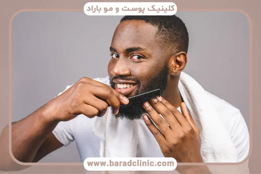 تجربیات واقعی کاشت ریش اینستا 