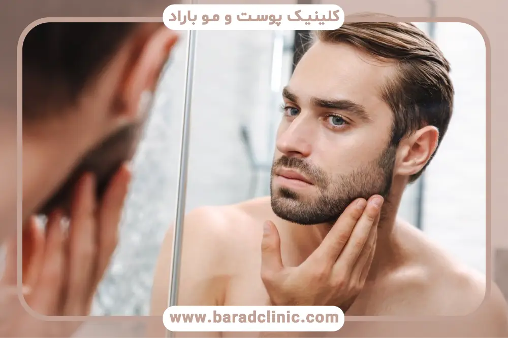 روش‌های رایج کاشت ریش