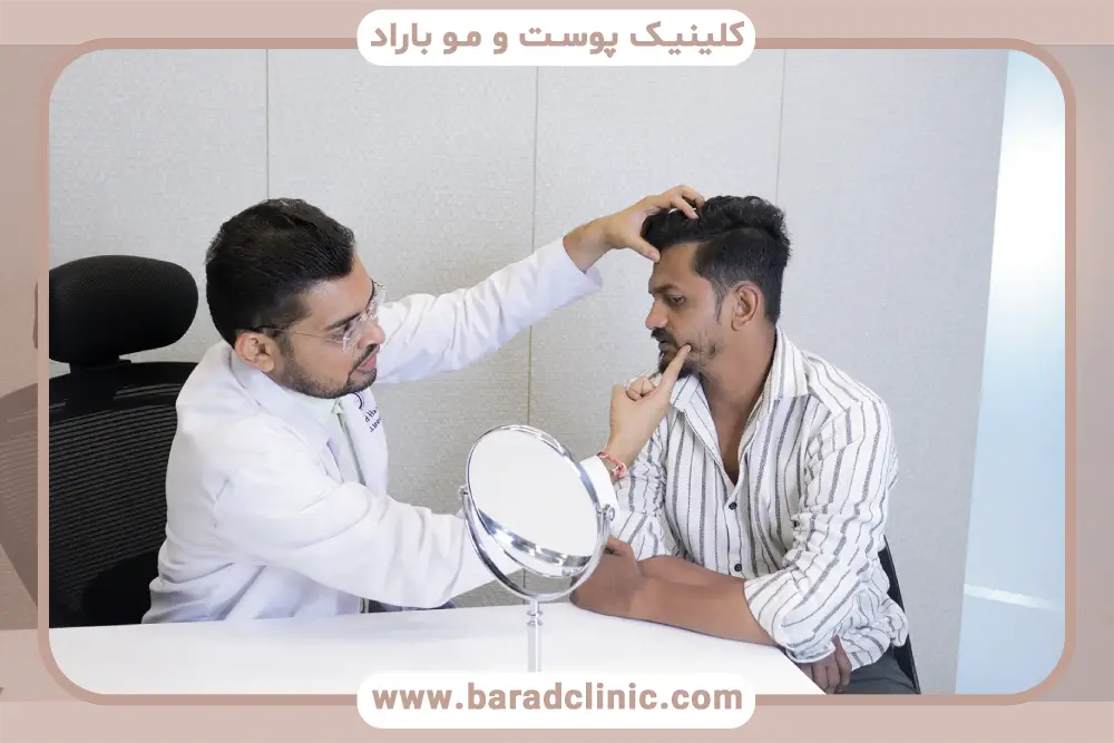 مزایای کاشت ریش صورت 